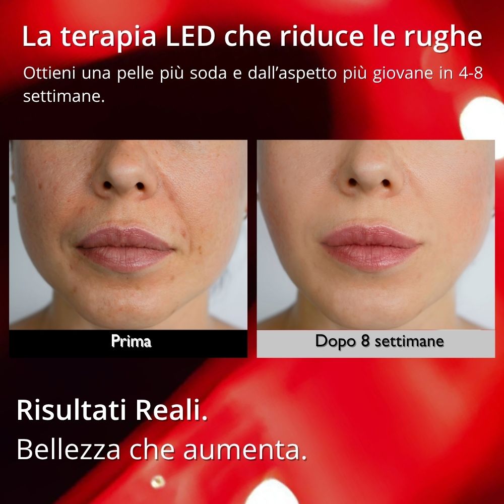 VENEZIANA™ - LED Mask